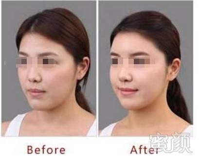 https://img.miyanlife.com/mnt/timg/180801/12322A047-3.jpg