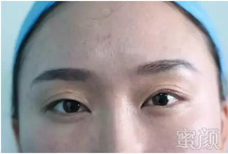 https://img.miyanlife.com/mnt/timg/180801/194351J91-1.jpg