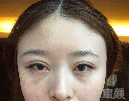 https://img.miyanlife.com/mnt/timg/180802/1140253637-0.jpg
