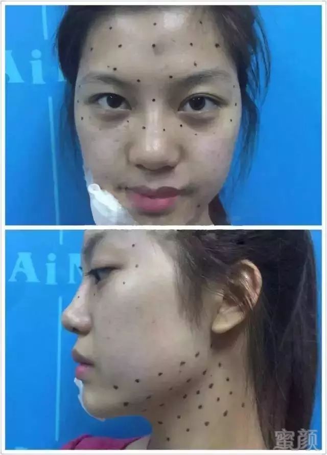 https://img.miyanlife.com/mnt/timg/180802/11424K494-4.jpg