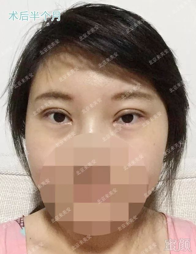 https://img.miyanlife.com/mnt/timg/180802/12005L360-3.jpg