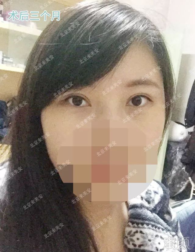 https://img.miyanlife.com/mnt/timg/180802/12005U455-4.jpg