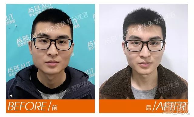https://img.miyanlife.com/mnt/timg/180802/12091350J-2.jpg
