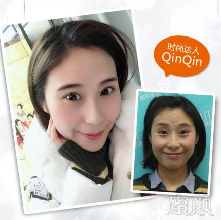 https://img.miyanlife.com/mnt/timg/180802/1209142G3-7.jpg