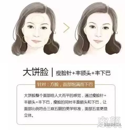 https://img.miyanlife.com/mnt/timg/180802/1211564158-3.jpg