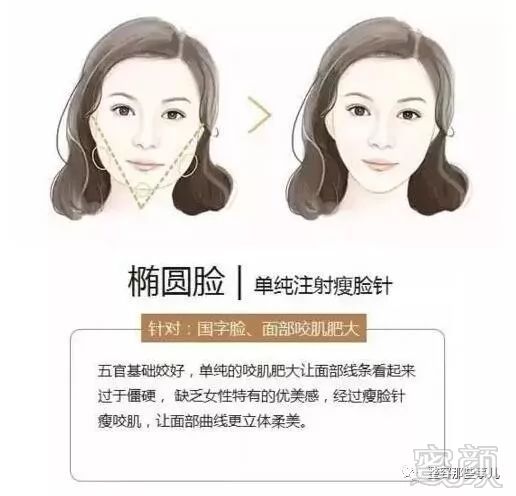 https://img.miyanlife.com/mnt/timg/180802/12115C260-1.jpg