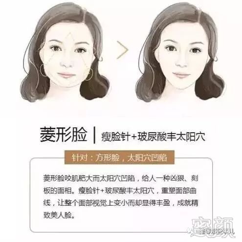 https://img.miyanlife.com/mnt/timg/180802/12115HK2-4.jpg