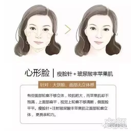 https://img.miyanlife.com/mnt/timg/180802/12115L0W-5.jpg