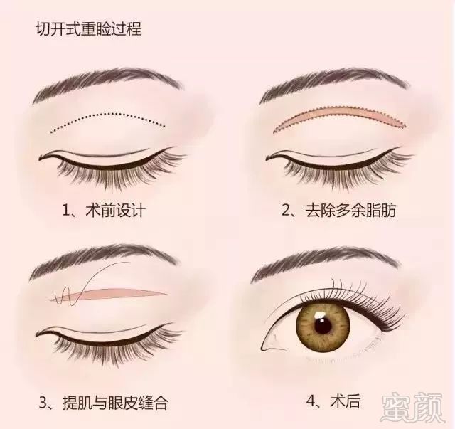 https://img.miyanlife.com/mnt/timg/180802/1242333414-4.jpg
