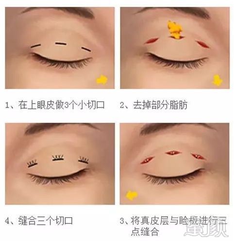 https://img.miyanlife.com/mnt/timg/180802/124233I46-5.jpg