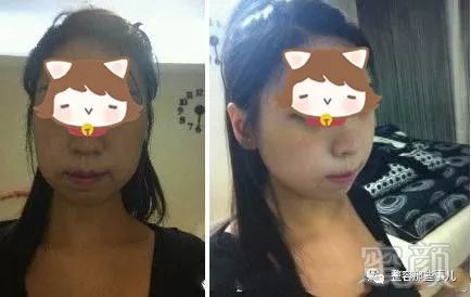 https://img.miyanlife.com/mnt/timg/180802/12560J255-1.jpg