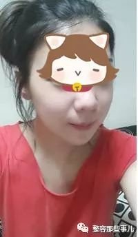 https://img.miyanlife.com/mnt/timg/180802/12560LH5-5.jpg