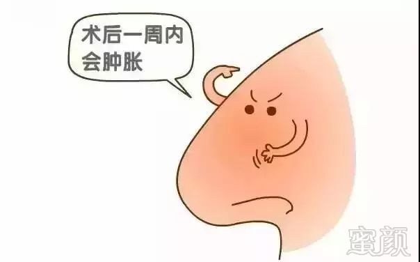 https://img.miyanlife.com/mnt/timg/180802/1302224428-4.jpg