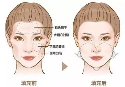 https://img.miyanlife.com/mnt/timg/180802/1305225I3-1.jpg