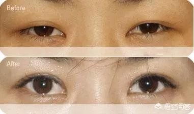 https://img.miyanlife.com/mnt/timg/180802/13064L336-2.jpg
