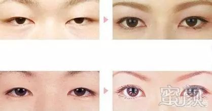 https://img.miyanlife.com/mnt/timg/180802/13064S618-4.jpg