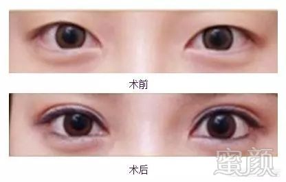 https://img.miyanlife.com/mnt/timg/180802/13064UI8-6.jpg