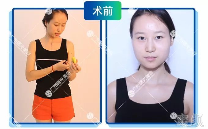 https://img.miyanlife.com/mnt/timg/180802/130P53492-6.jpg
