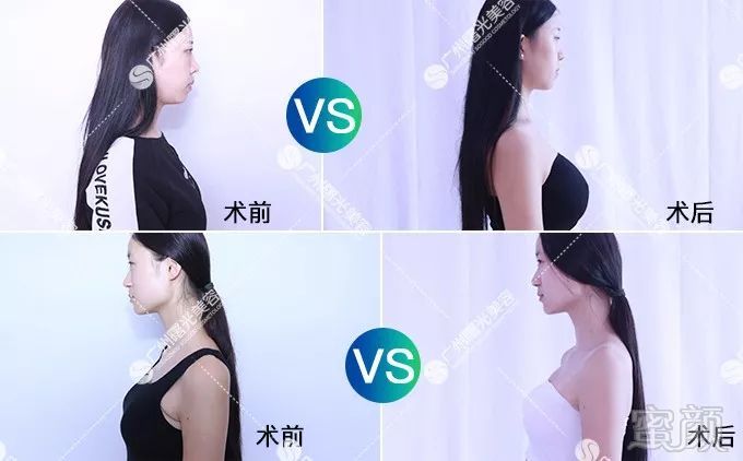 https://img.miyanlife.com/mnt/timg/180802/130PI4L-14.jpg