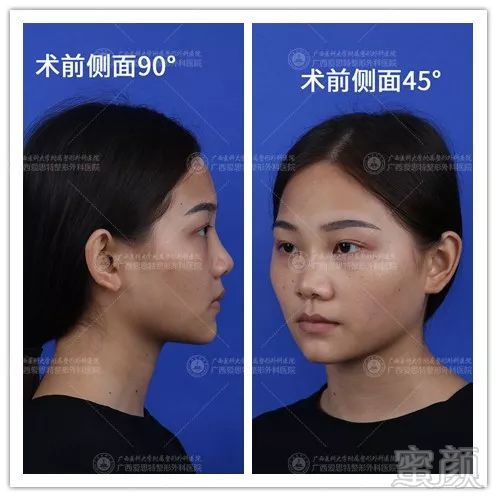 https://img.miyanlife.com/mnt/timg/180802/1315091519-6.jpg