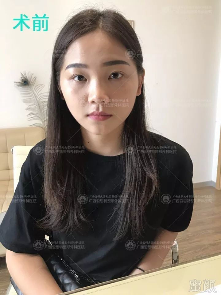 https://img.miyanlife.com/mnt/timg/180802/1315104034-7.jpg