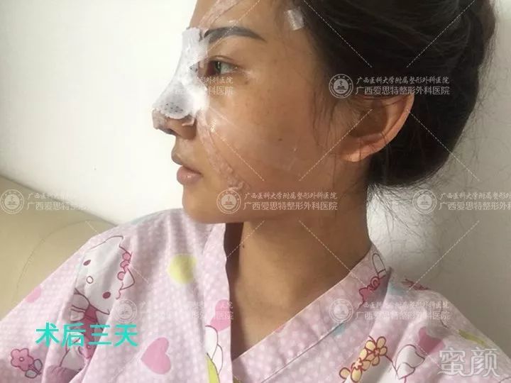 https://img.miyanlife.com/mnt/timg/180802/1315104G4-13.jpg