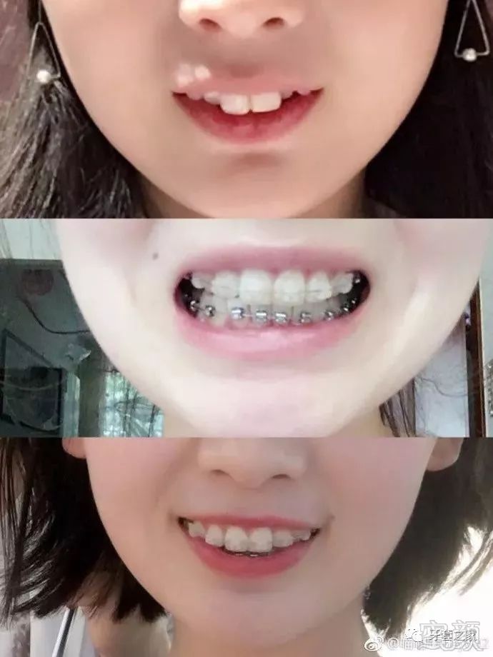 https://img.miyanlife.com/mnt/timg/180802/1322091933-0.jpg