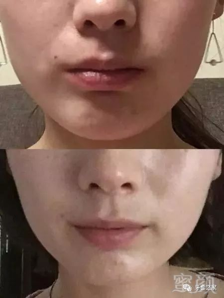 https://img.miyanlife.com/mnt/timg/180802/1322106146-1.jpg