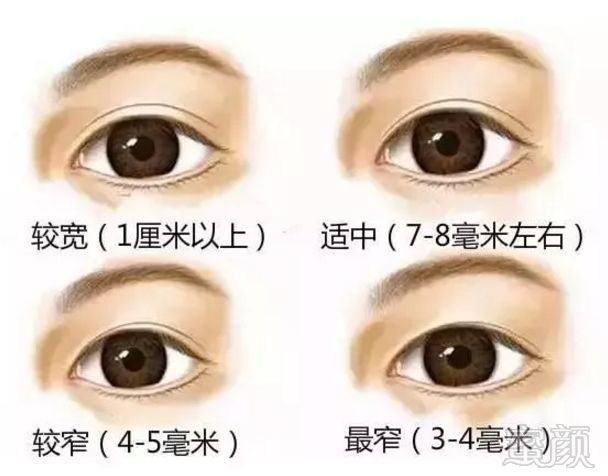 https://img.miyanlife.com/mnt/timg/180803/1300221136-0.jpg