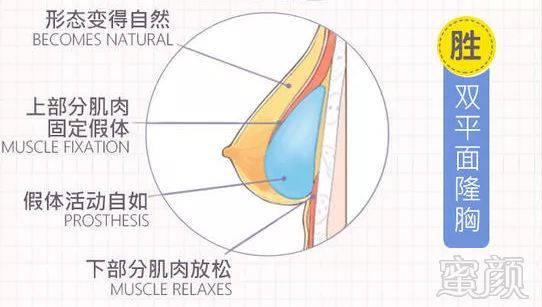 https://img.miyanlife.com/mnt/timg/180803/1306001255-8.jpg