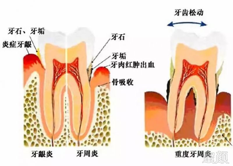 案例图片