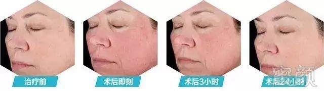 https://img.miyanlife.com/mnt/timg/180803/1321153O3-10.jpg