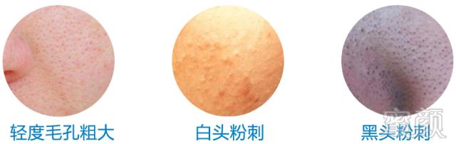 https://img.miyanlife.com/mnt/timg/180803/13214V121-4.jpg
