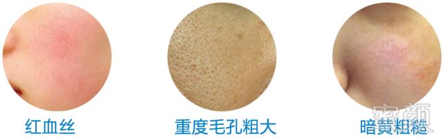 https://img.miyanlife.com/mnt/timg/180803/1321511559-5.jpg