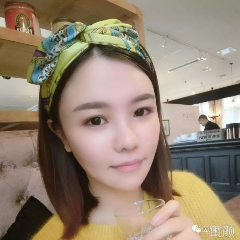 https://img.miyanlife.com/mnt/timg/180803/1322103622-6.jpg