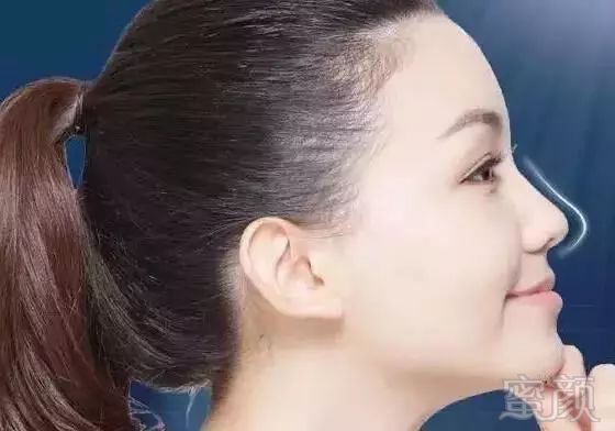 https://img.miyanlife.com/mnt/timg/180803/13395141D-2.jpg
