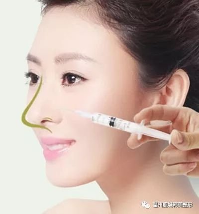 https://img.miyanlife.com/mnt/timg/180803/1339523611-3.jpg