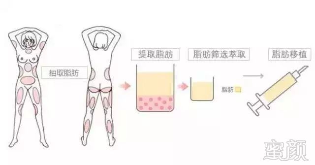 https://img.miyanlife.com/mnt/timg/180803/144012B52-14.jpg