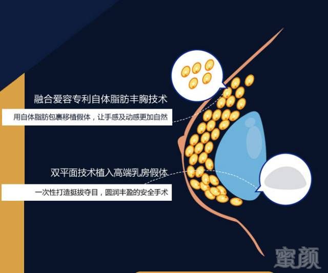 https://img.miyanlife.com/mnt/timg/180803/144012D49-15.jpg