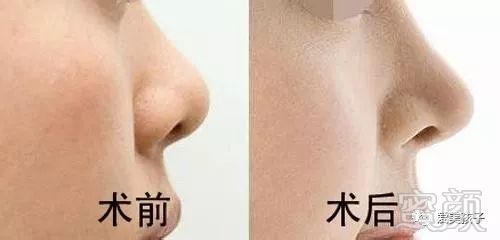 https://img.miyanlife.com/mnt/timg/180803/1445135928-1.jpg