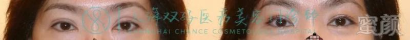 https://img.miyanlife.com/mnt/timg/180804/1102354L8-4.jpg