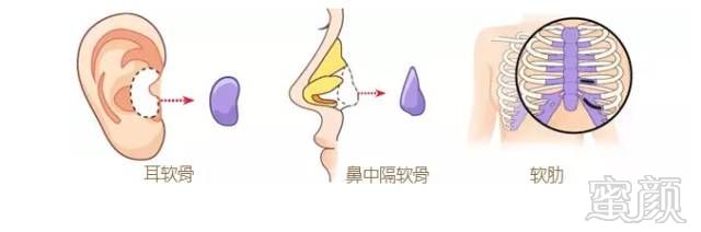 https://img.miyanlife.com/mnt/timg/180804/11053aT7-2.jpg