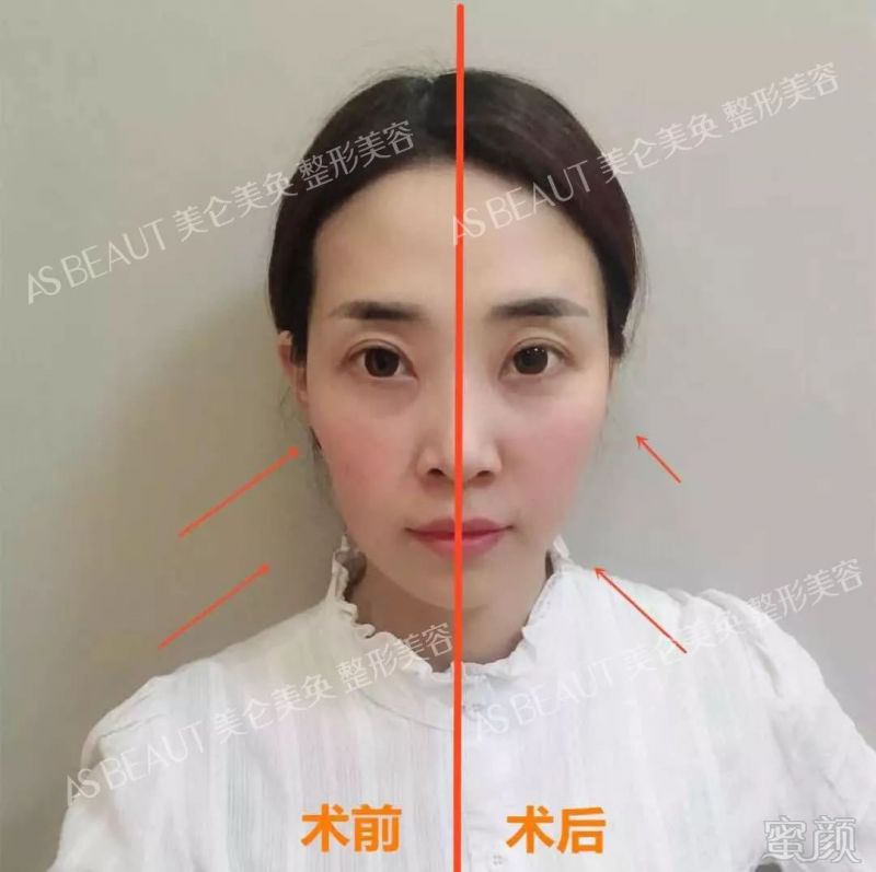 https://img.miyanlife.com/mnt/timg/180804/1106415E1-6.jpg