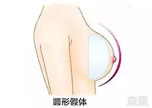 https://img.miyanlife.com/mnt/timg/180804/111119ET-5.jpg