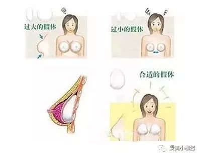 https://img.miyanlife.com/mnt/timg/180804/11131R422-0.jpg