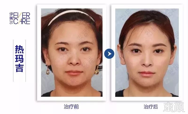 https://img.miyanlife.com/mnt/timg/180804/11231341B-0.jpg