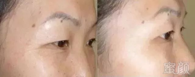https://img.miyanlife.com/mnt/timg/180804/1123143224-3.jpg