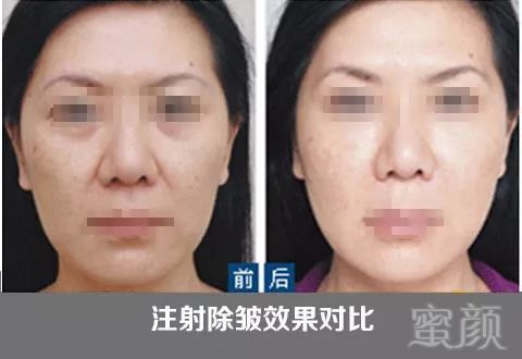 https://img.miyanlife.com/mnt/timg/180804/11262Qa9-14.jpg
