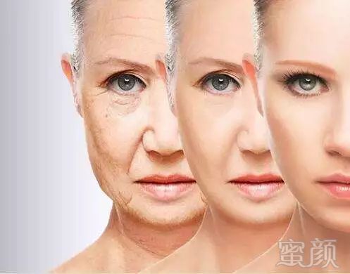 https://img.miyanlife.com/mnt/timg/180804/11292210N-2.jpg
