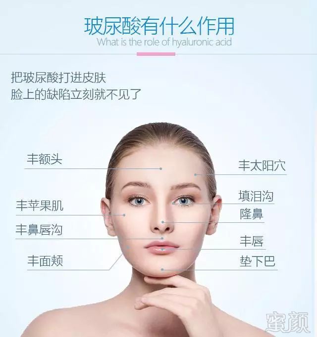 https://img.miyanlife.com/mnt/timg/180804/1129232G7-3.jpg